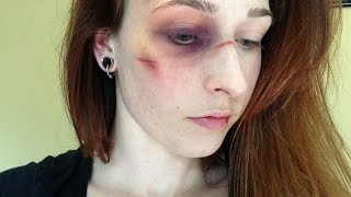 Bruised Makeup Tutorial [upl. by Merill622]