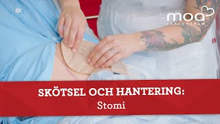 Skötsel och hantering  Stomi [upl. by Finnegan]