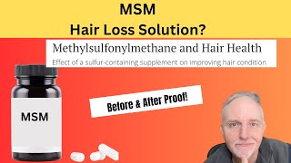 MSM for Fuller Healthier Hair Growth Latest Research [upl. by Nnylekoorb]