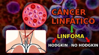 LINFOMAS  Un CÁNCER del SISTEMA INMUNE🩻 [upl. by Vrablik]