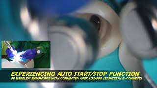 auto startstop endomotor econnect pro eighteeth apex locator endodontic treatment [upl. by Akcebar219]