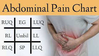 Abdominal Pain Causes by Location and Quadrant Differential Diagnosis Chart [upl. by Esojnauj16]