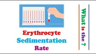 Hematology  Erythrocyte Sedimentation Rate ESR [upl. by Ilamad]