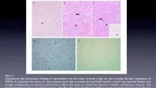 Superparamagnetic iron oxide nanoparticles  Video abstract 23638 [upl. by Erasaec]