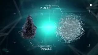 Beta amyloid and Tau proteins HUMAN transglutaminase substrates LIKE GLUTEN and CASEIN LECMA [upl. by Eppie]