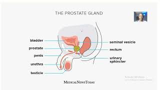 Anatomy of the prostate gland Diameters Weight shape and surfaces [upl. by Ardeen]