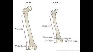 Benign bone tumourosteoma osteoid osteomaosteoblastoma [upl. by Hump132]