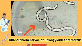 Understanding Strongyloides Rhabditiform Larvae A Comprehensive Guide  Parasitology [upl. by Atte]