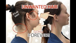 How To Get Rid Of Hair Forever Face Sideburns Neck [upl. by Atiniuq]