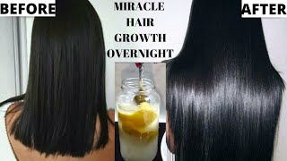 HAIR GROWTH SECRET  How To Grow Longer Thicker Hair Naturally amp Fast  CURE HAIR LOSS DIY REMEDY [upl. by Shanleigh]