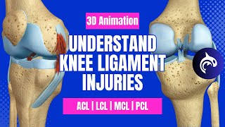 Understand Knee Ligament Injuries ACL PCL MCL LCL  3D animation [upl. by Afira398]