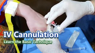 IV Cannulation  Learn the Basic Technique  IV Cannula [upl. by Enilrad128]