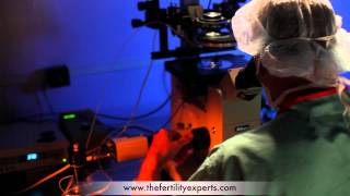 ICSI Procedure  IVF Intracytoplasmic Sperm Injection [upl. by Bunnie]