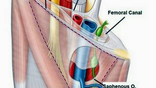 Femoral TriangleSheathCanalHernia [upl. by Arissa]