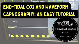 EndTidal CO2 and Waveform Capnography An Easy Tutorial Explicit [upl. by Anaele351]