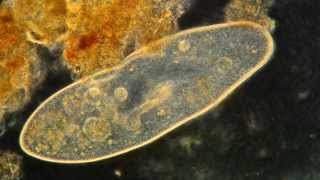 Paramecium Feeding Magnified 400X High Definition [upl. by Downall]