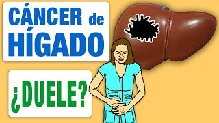 El cáncer de hígado ¿duele [upl. by Amieva]