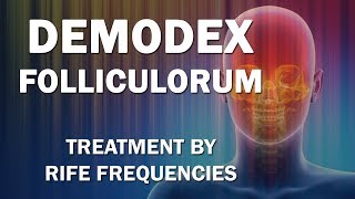 Demodex Folliculorum  RIFE Frequencies Treatment  Energy amp Quantum Medicine with Bioresonance [upl. by Robb676]