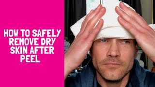 HOW TO SAFELY REMOVE DRY AND FLAKY SKIN AFTER A PEEL [upl. by Painter780]