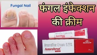 Amrobrut cream  Benefits Side effects Price How it works in body  Nail infection  Athlete foot [upl. by Susanne193]