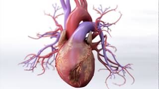 What is Coronary Artery Disease  Mechanism of Disease [upl. by Kasey]