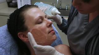 How does the IPL Photofacial work Watch and learn  Seiler Skin [upl. by Killigrew]