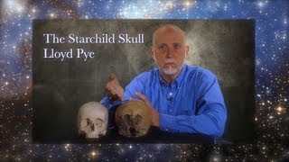 Starchild Skull DNA is Alien  Lloyd Pye [upl. by Airb256]