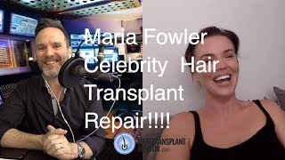 Maria Fowler FUE Hair Transplant Repair Interview  Part 1 [upl. by Rodman]