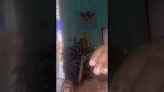 Scratching oily flakes dandruffcauses naturalhair dandruff dandruffflakes dandruffheadshave [upl. by Ianahs]