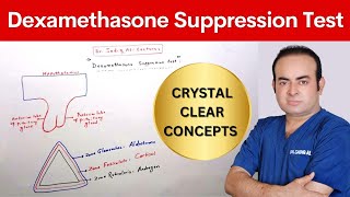 Dexamethasone Suppression Test  Dr Sadiq Ali [upl. by Casanova]