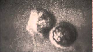 Lamellipodia and Filopodia of the Ameboid Sperm wmv wlmp [upl. by Tybald503]