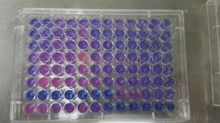 Resazirun Test for Metabolic Activity of Bacteria [upl. by Hnib]