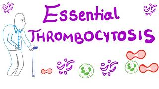 Essential Thrombocytosis ET  Myeloproliferative Neoplasm JAK2 Kinase [upl. by Adaminah]