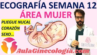 ECOGRAFÍA SEMANA 12⏰  PLIEGUE NUCAL CORAZÓN♥️ EXTREMIDADES SEXO  Ginecología y Obstetricia [upl. by Sikorski249]