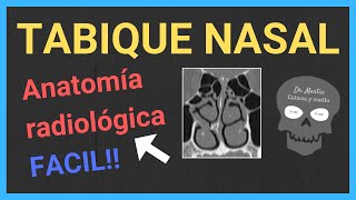 👃TABIQUE NASAL TAC anatomía [upl. by Tait]