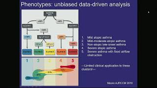 Treatment Options in Severe Eosinophilic Asthma mp4 [upl. by Soiritos263]