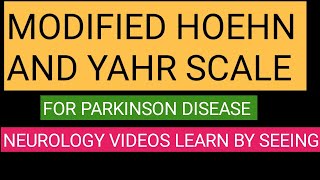 Modified Hoehn and Yahr Scale to grade disability IN PARKINSON disease [upl. by Mike]