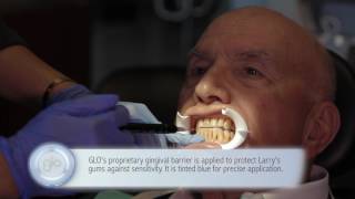 GLO Science Professional  Chairside Whitening with Larry Cohen [upl. by Mort]