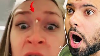 Popping huge blackheads and Giant Pimples Best Pimple Popping Videos [upl. by Shermy]