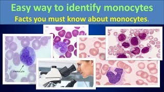 Easy way to identify monocytesEasy way to identify monocytes [upl. by Matless]