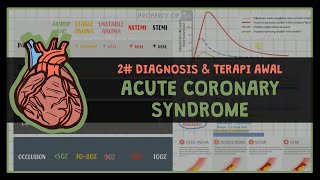 12 DIAGNOSIS DAN TERAPI SINDROM KORONER AKUT 2 ISCHEMIC HEART DIASEASE [upl. by Corson]