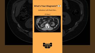 Whats Your Diagnosis 👀radiology ct ctscan abdomen doctor medicalstudent medicaltest [upl. by Adnopoz]