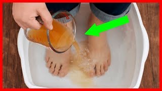 Revive Tired Feet and Eliminate Toxins With This DIY Foot Detox Soak [upl. by Palestine]