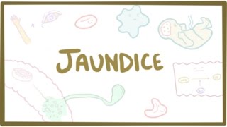 Jaundice  causes treatment amp pathology [upl. by Ettenowtna]