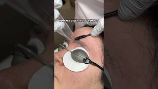 LASER TATTOO REMOVAL ASMR 😲HOW SATISFYING shorts laser subscribe video edit viral fyp asmr [upl. by Ednargel]