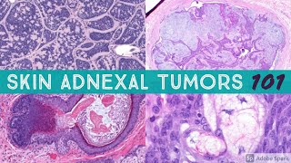 Skin Adnexal Tumors 101 A Basic Approach for General Pathologists [upl. by Anitsuj497]