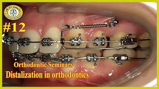 12 Distalization in orthodontics سيمينارات تقويم الأسنان جامعة الأزهر [upl. by Terrena]