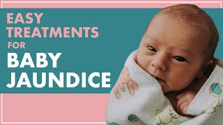 BABY JAUNDICE  Treating JAUNDICE In Babies From HOME [upl. by Llywellyn]