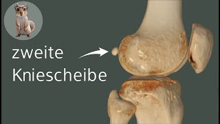 Die zweite Kniescheibe  die Fabella anatomie medizin anatomy [upl. by Jesher]