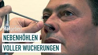 Polypen Wenn die Operation nicht hilft  Gesundmacher 25  die Ratgeber [upl. by Alber365]